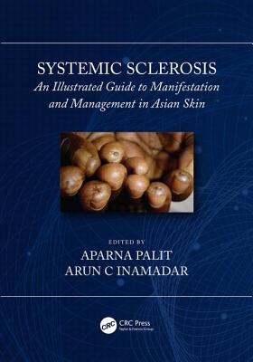 Systemic Sclerosis: An Illustrated Guide to Manifestation and Management in Asian Skin - Inamadar, Arun C (Editor), and Palit, Aparna (Editor)