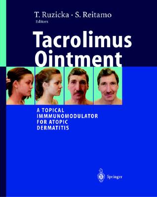 Tacrolimus Ointment: A Topical Immunomodulator for Atopic Dermatitis - Valiente, Gabriel A, and Ruzicka, T (Editor), and Reitamo, S (Editor)