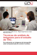 Tecnicas de Analisis de Imagenes Para El Estudio de Tac.