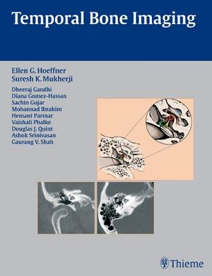 Temporal Bone Imaging - Hoeffner, Ellen G (Editor), and Mukherji, Suresh Kumar (Editor), and Gandhi, Dheeraj (Editor)