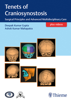 Tenets of Craniosynostosis: Surgical Principles and Advanced Multidisciplinary Care - Gupta, Deepak (Editor), and Mahapatra, Ashok (Editor)