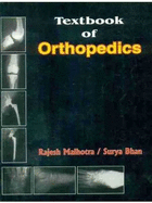 Textbook of Orthopedics