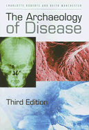 The Archaeology of Disease