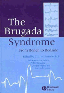 The Brugada Syndrome: From Bench to Bedside