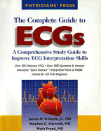 The Complete Guide to Ecgs