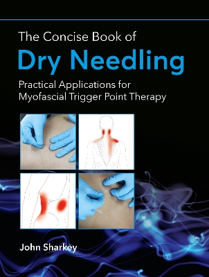 The Concise Book of Dry Needling: Practical Applications for Myofascial Trigger Point Therapy - Sharkey, John