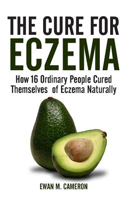 The Cure for Eczema - Cameron, Ewan M