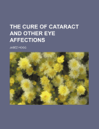 The Cure of Cataract and Other Eye Affections