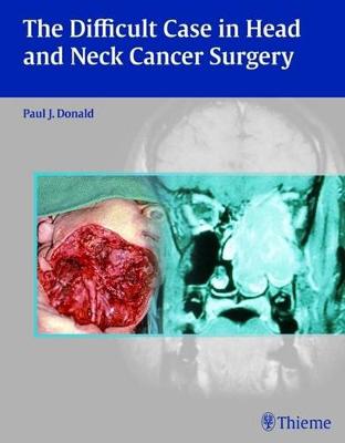 The Difficult Case in Head and Neck Cancer Surgery - Donald, Paul J