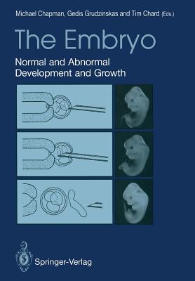 The Embryo: Normal and Abnormal Development and Growth - Chapman, Michael G (Editor), and Grudzinskas, J Gedis (Editor), and Chard, Tim (Editor)