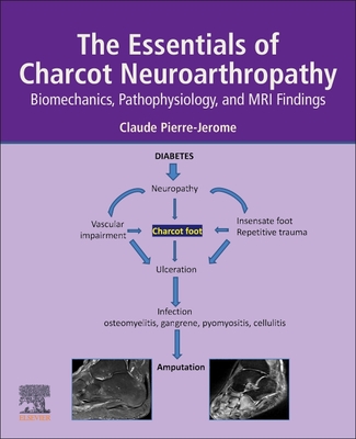 The Essentials of Charcot Neuroarthropathy: Biomechanics, Pathophysiology, and MRI Findings - Pierre-Jerome, Claude
