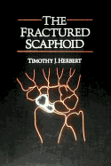 The Fractured Scaphoid