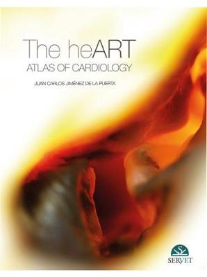 The Heart. Atlas of Cardiology - de la Puerta, Juan Carlos Jimnez