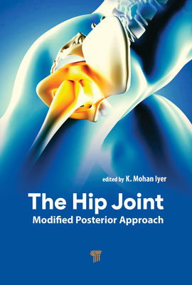 The Hip Joint: Modified Posterior Approach - Iyer, K Mohan