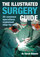 The Illustrated Surgery Guide: A step-by-step guide to 20 common operations