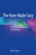 The Knee Made Easy