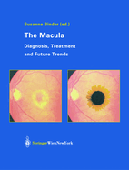 The Macula: Diagnosis, Treatment and Future Trends