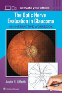 The Optic Nerve Evaluation in Glaucoma: An Interactive Workbook