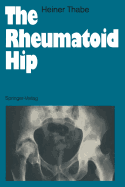 The Rheumatoid Hip