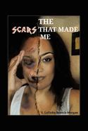 The Scars That Made Me
