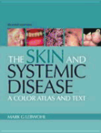 The Skin and Systemic Disease: A Color Atlas and Text