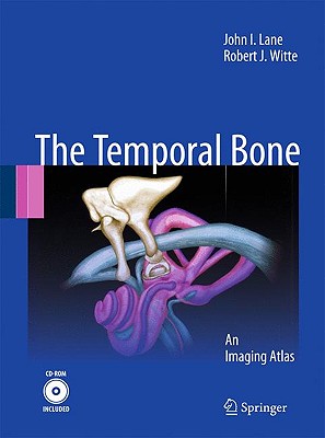 The Temporal Bone: An Imaging Atlas - Lane, John I, and Witte, Robert J