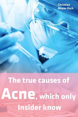 The True Causes of Acne, Which Only Insider Know - Meyer-Esch, Christian