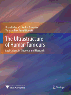 The Ultrastructure of Human Tumours: Applications in Diagnosis and Research