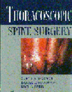 Thoracoscopic Spine Surgery