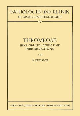 Thrombose: Ihre Grundlagen Und Ihre Bedeutung - Dietrich, Albert