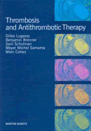 Thrombosis and Anti-Thrombotic Therapy
