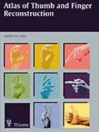 Thumb and Finger Reconstruction: Interesting Topics in Hand Surgery