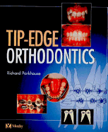 Tip-Edge Orthodontics