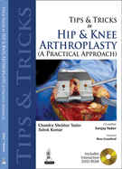 Tips and Tricks in Hip and Knee Arthroplasty: (A Practical Approach)