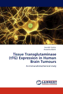 Tissue Transglutaminase (Ttg) Expression in Human Brain Tumours