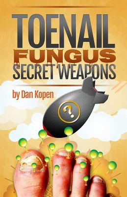 Toenail Fungus Secret Weapons: Uncover over 14 toenail fungus treatments that you can combine to clear your toe nails in under 45 days! - Kopen, Dan