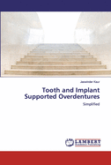 Tooth and Implant Supported Overdentures