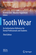 Tooth Wear: An Authoritative Reference for Dental Professionals and Students