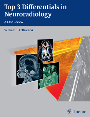 Top 3 Differentials in Neuroradiology: A Case Review - O'Brien, William T.