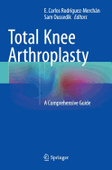 Total Knee Arthroplasty: A Comprehensive Guide