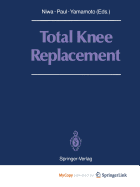 Total Knee Replacement