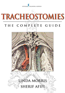 Tracheostomies: The Complete Guide