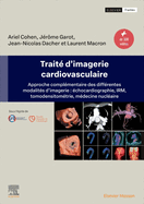 Trait d'Imagerie Cardiovasculaire: Approche Complmentaire Des Diffrentes Modalits d'Imagerie: chocardiographie, Irm, Tomodensitomtrie, Mdecine Nuclaire