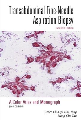 Transabdominal Fine-Needle Aspiration Biopsy (2nd Edition): A Color Atlas and Monograph - Yang, Grace C H, and Tao, Liang-Che