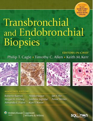 Transbronchial and Endobronchial Biopsies - Cagle, Philip T, MD, and Allen, Timothy C, MD, Jd (Editor)