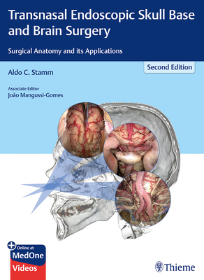 Transnasal Endoscopic Skull Base and Brain Surgery: Surgical Anatomy and Its Applications - Stamm, Aldo C (Editor)