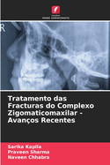 Tratamento das Fracturas do Complexo Zigomaticomaxilar - Avanos Recentes