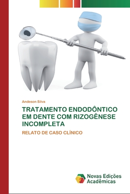 Tratamento Endod Ntico Em Dente Com Rizog Nese Incompleta By Andeson Silva Alibris