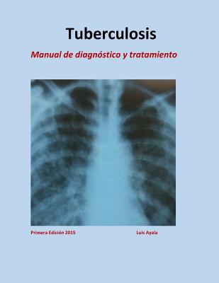 Tratamiento de Tuberculosis: Manual de diagnstico y tratamiento - Arriaga, Yessy Carolina, and Ayala, Luis Alonso