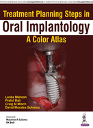 Treatment Planning Steps in Oral Implantology: A Color Atlas